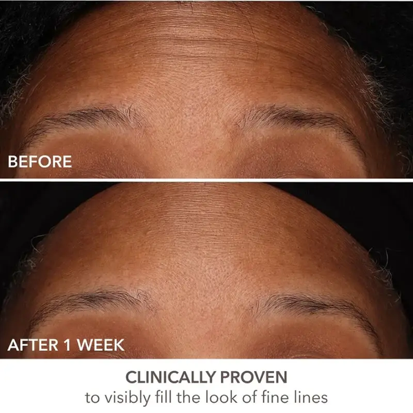 Dr. dennis gross skincare derminfusions&trade; fill + repair serum with Hyaluronic Acid 7 мл 1912762506 фото