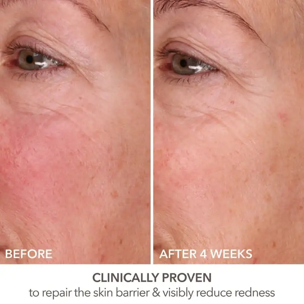 Dr. dennis gross skincare derminfusions&trade; fill + repair serum with Hyaluronic Acid 7 мл 1912762506 фото