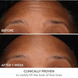Dr. dennis gross skincare derminfusions&trade; fill + repair serum with Hyaluronic Acid 7 мл 1912762506 фото 4