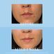 Гель-крем для проблемной кожи и точечного лечения акне Kate Somerville EradiKate Acne Mark Fading Gel 30 мл 710757739 фото 2